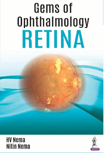 Gems of Ophthalmology: Retina