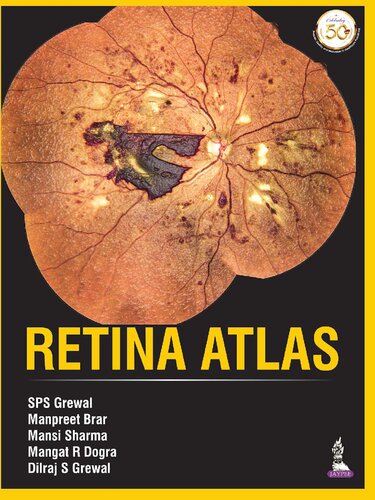 Retina Atlas