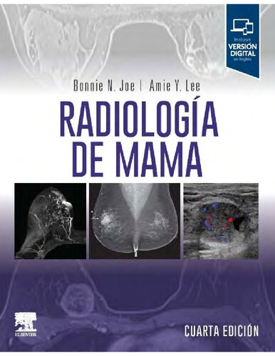 Radiologia de Mama