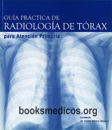 Guía Práctica de Radiología de Tórax para atención primaria