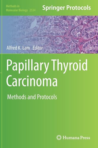 Papillary Thyroid Carcinoma: Methods and Protocols (Methods in Molecular Biology, 2534)
