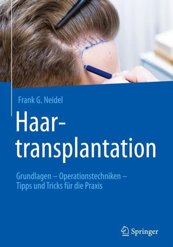 Haartransplantation: Grundlagen - Operationstechniken - Tipps und Tricks für die Praxis