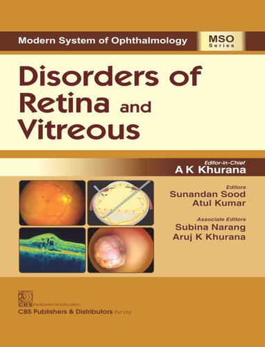 Disorders of Retina and Vitreous (Modern System of Ophthalmology (MSO) Series)