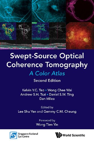 Swept-Source Optical Coherence Tomography: A Color Atlas: Second Edition