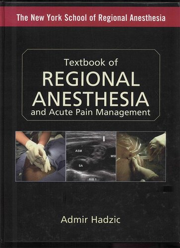 Textbook of Regional Anesthesia and Acute Pain Management