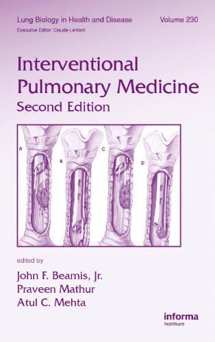 Interventional Pulmonary Medicine, Second Edition, Volume 230 (Lung Biology in Health and Disease)