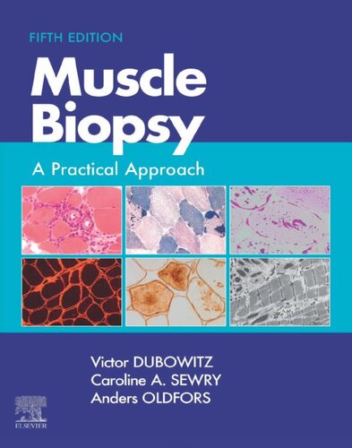 Muscle Biopsy: A Practical Approach