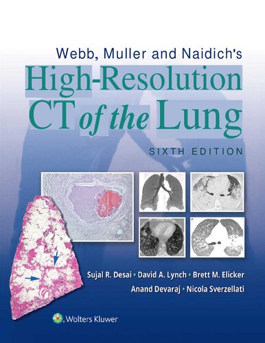 Webb, Müller and Naidich's High-Resolution CT of the Lung