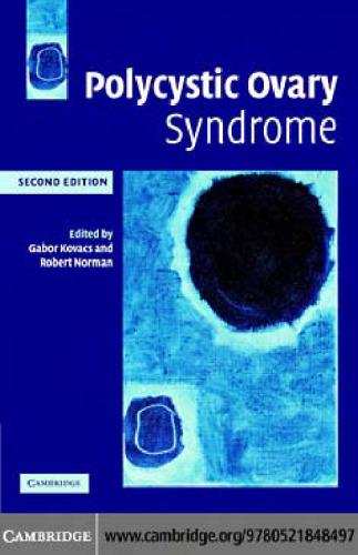 Polycystic Ovary Syndrome; 2nd edition