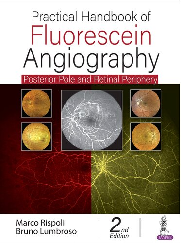 Practical Handbook of Fluorescein Angiography: Posterior Pole and Retinal Periphery