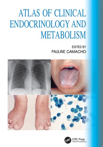 Atlas of Clinical Endocrinology and Metabolism (Feb 16, 2024)_(0367608359)_(CRC Press)