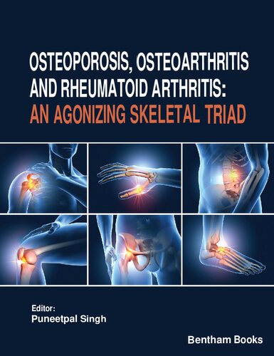 Osteoporosis, Osteoarthritis and Rheumatoid Arthritis - An Agonizing Skeletal Triad (Nov 7, 2023)_(981519609X)_(Bentham Science Publishers)