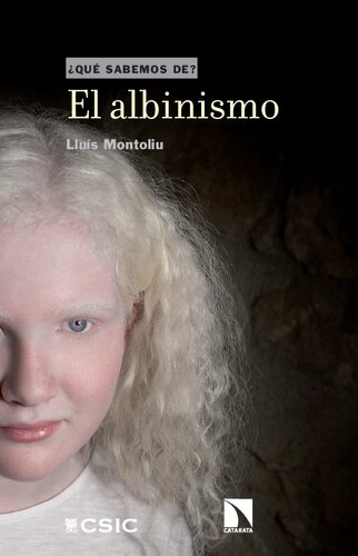 El albinismo (¿Qué sabemos de?) (Spanish Edition)