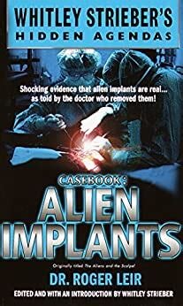 Casebook: Alien Implants
