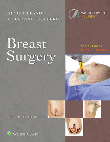 Master Techniques in Surgery: Breast Surgery (Master Techiques in Surgery)