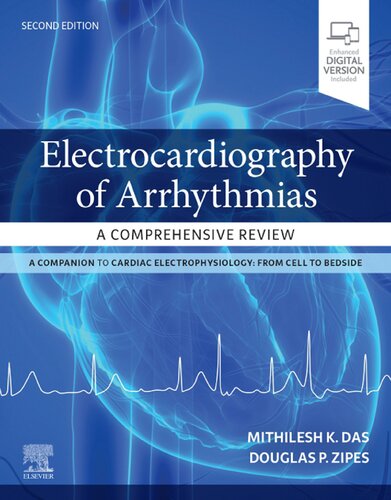 Electrocardiography of Arrhythmias: A Comprehensive Review: A Companion to Cardiac Electrophysiology