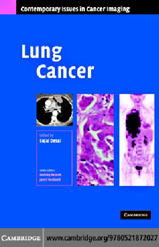 Lung Cancer