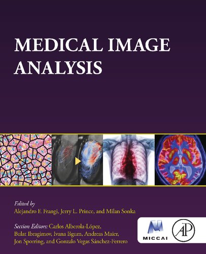 Medical Image Analysis (The MICCAI Society book Series)