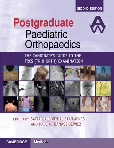 Postgraduate Paediatric Orthopaedics - The Candidate's Guide to the FRCS(Tr&Orth) Examination, 2e (April 4, 2024)_(1108970613)_(Cambridge University Press)