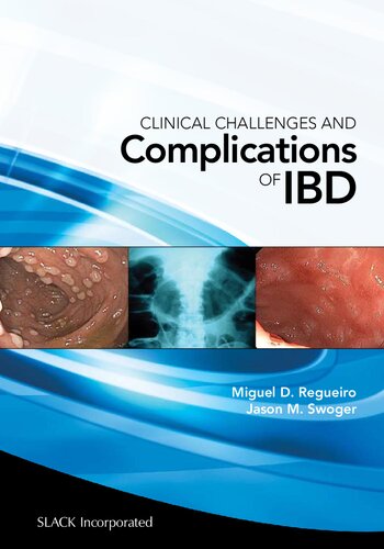Clinical Challenges and Complications of IBD (Oct 15, 2012)_(1556429800)_(Slack Incorporated)