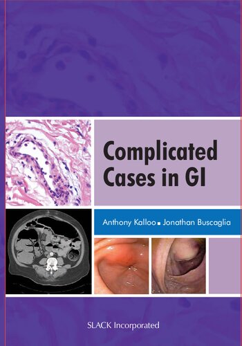 Complicated Cases in GI (Feb 15, 2009)_(1556428111)_(Slack Incorporated).pdf
