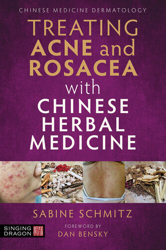 Treating Psoriasis with Chinese Herbal Medicine (Revised Edition): A Practical Handbook