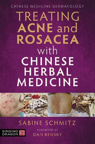 Treating Psoriasis with Chinese Herbal Medicine (Revised Edition): A Practical Handbook