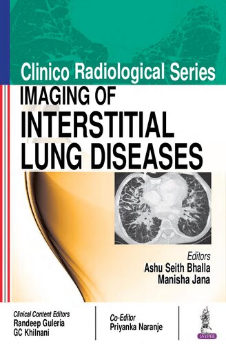 Clinico Radiological Series - Imaging of Interstitial Lung Diseases (April 30, 2017)_(938632251X)_(Jaypee Brothers Medical Publishers Pvt. Ltd.)
