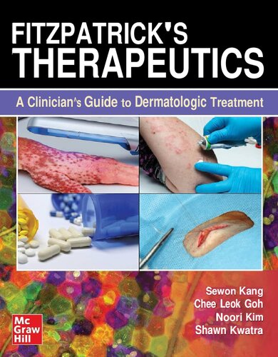 Fitzpatrick's Therapeutics: A Clinician's Guide to Dermatologic Treatment