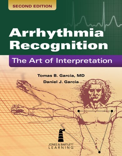 Arrhythmia Recognition: The Art of Interpretation