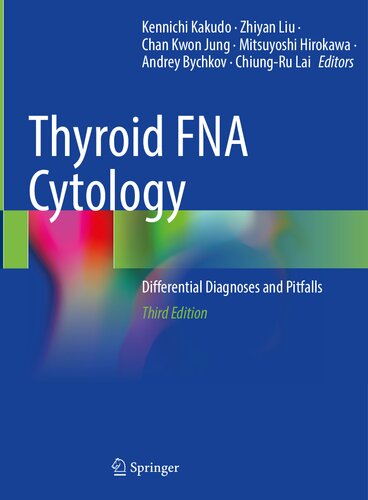 Thyroid FNA Cytology: Differential Diagnoses and Pitfalls