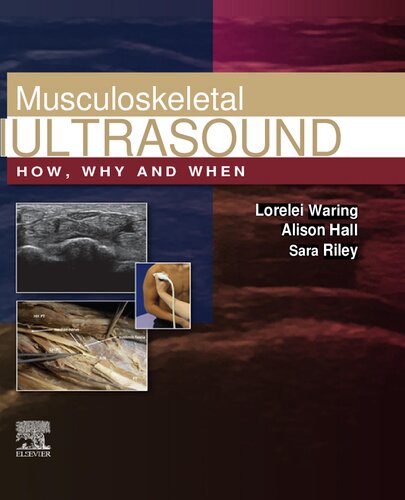 Musculoskeletal Ultrasound: How, Why and When