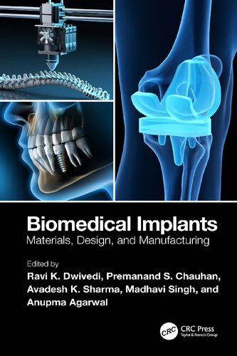 Biomedical Implants. Materials, Design, and Manufacturing