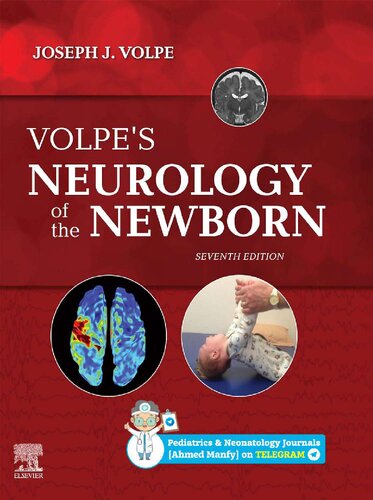 Volpe's Neurology of the Newborn