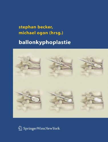 Ballonkyphoplastie (German Edition)