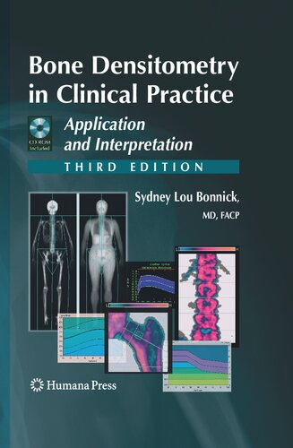 Bone Densitometry in Clinical Practice: Application and Interpretation