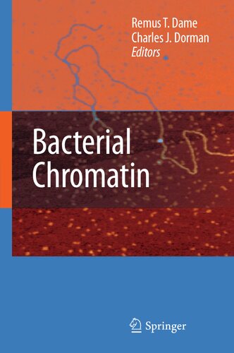 Bacterial Chromatin
