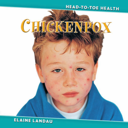 Chickenpox (Head-to-Toe Health)