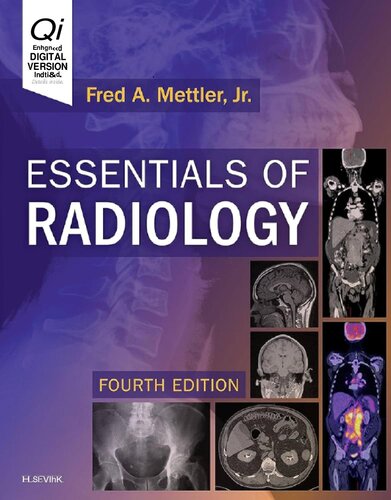 Essentials of Radiology - Common Indications and Interpretation, 4e (Oct 25, 2018)_(0323508871)_(Elsevier).pdf