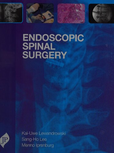 Endoscopic Spinal Surgery