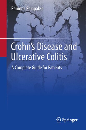 Crohn's Disease and Ulcerative Colitis: A Complete Guide for Patients