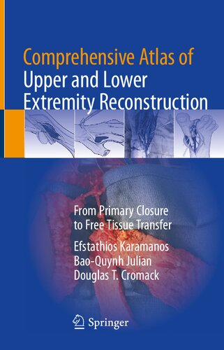 Comprehensive Atlas of Upper and Lower Extremity Reconstruction: From Primary Closure to Free Tissue Transfer