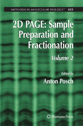 2D PAGE: Sample Preparation and Fractionation: Volume 2 (Methods in Molecular Biology, 425)