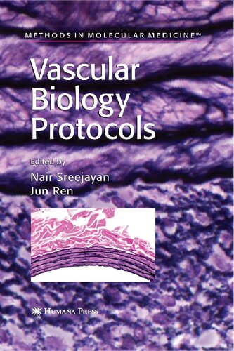 Vascular Biology Protocols (Methods in Molecular Medicine, 139)