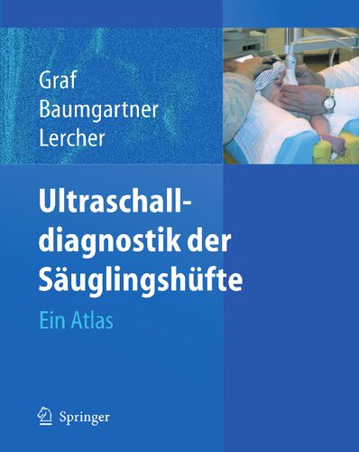 Ultraschalldiagnostik der Säuglingshüfte: Ein Atlas (German Edition)