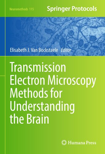 Transmission Electron Microscopy Methods for Understanding the Brain (Neuromethods, 115)