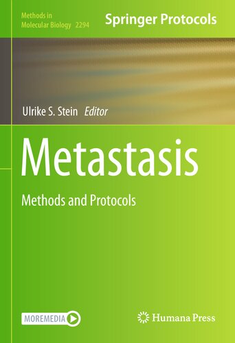Metastasis: Methods and Protocols (Methods in Molecular Biology, 2294)