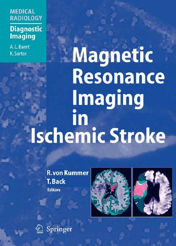 Magnetic Resonance Imaging in Ischemic Stroke (Medical Radiology)