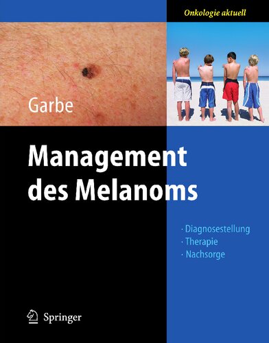 Management des Melanoms (Onkologie aktuell) (German Edition)