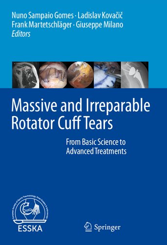 Massive and Irreparable Rotator Cuff Tears: From Basic Science to Advanced Treatments